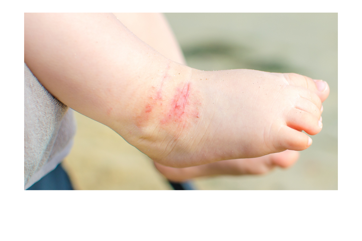 敏感肌・乾燥肌の子どもに【秋冬スキンケア経験記】